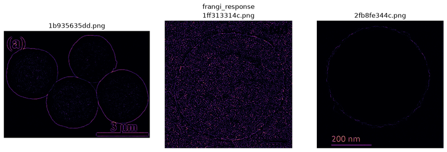 Feature extraction